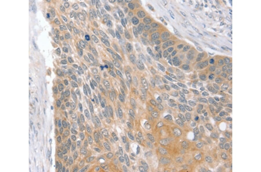 Immunohistochemistry - SIK1 Antibody from Signalway Antibody (37961) - Antibodies.com