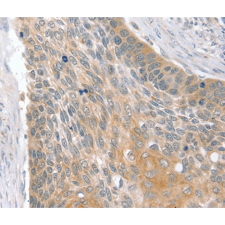 Immunohistochemistry - SIK1 Antibody from Signalway Antibody (37961) - Antibodies.com