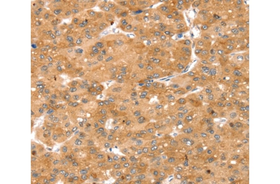 Immunohistochemistry - SNX1 Antibody from Signalway Antibody (37962) - Antibodies.com