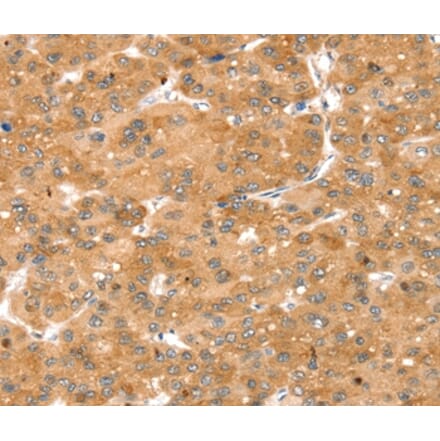 Immunohistochemistry - SNX1 Antibody from Signalway Antibody (37962) - Antibodies.com