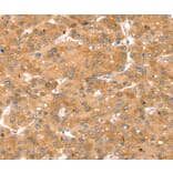 Immunohistochemistry - SNX1 Antibody from Signalway Antibody (37962) - Antibodies.com