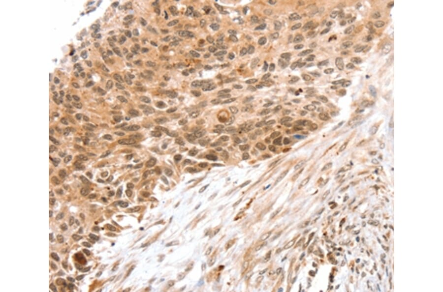 Immunohistochemistry - SNX1 Antibody from Signalway Antibody (37962) - Antibodies.com