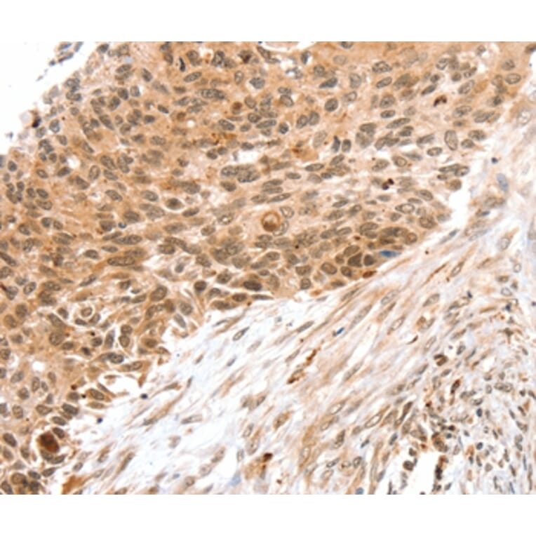 Immunohistochemistry - SNX1 Antibody from Signalway Antibody (37962) - Antibodies.com