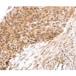 Immunohistochemistry - SNX1 Antibody from Signalway Antibody (37962) - Antibodies.com