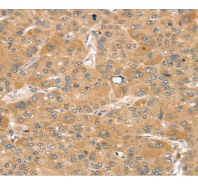 Immunohistochemistry - SNX2 Antibody from Signalway Antibody (37963) - Antibodies.com