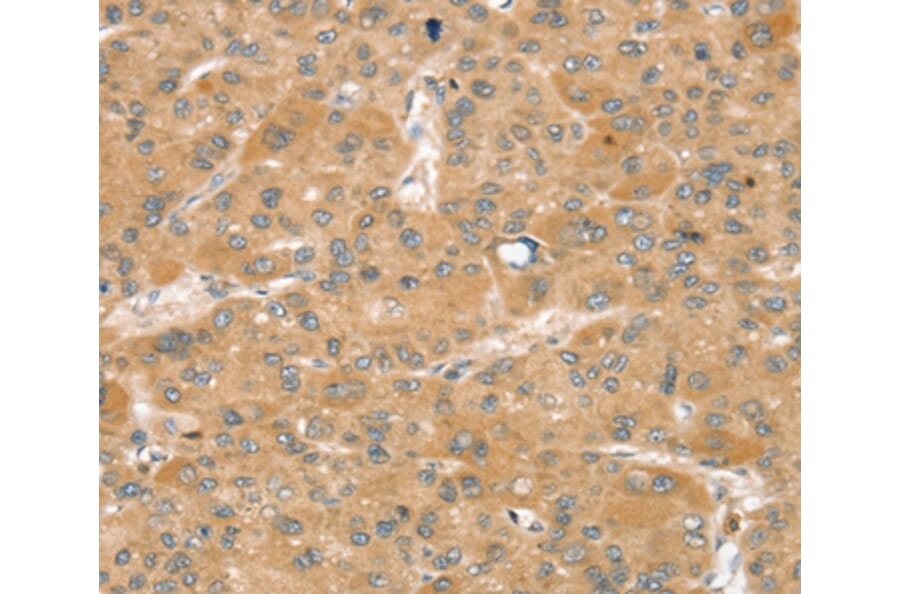 Immunohistochemistry - SNX2 Antibody from Signalway Antibody (37963) - Antibodies.com
