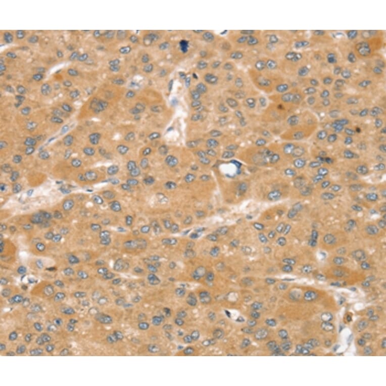 Immunohistochemistry - SNX2 Antibody from Signalway Antibody (37963) - Antibodies.com