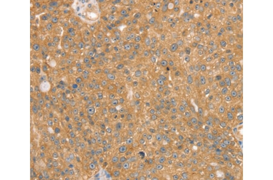 Immunohistochemistry - SNX2 Antibody from Signalway Antibody (37963) - Antibodies.com