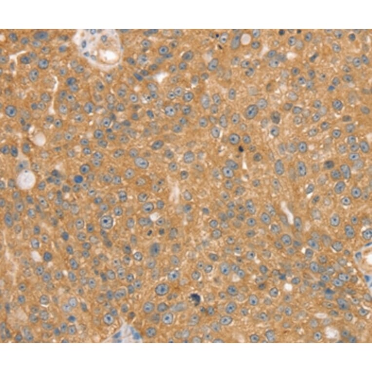 Immunohistochemistry - SNX2 Antibody from Signalway Antibody (37963) - Antibodies.com