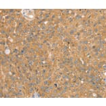 Immunohistochemistry - SNX2 Antibody from Signalway Antibody (37963) - Antibodies.com