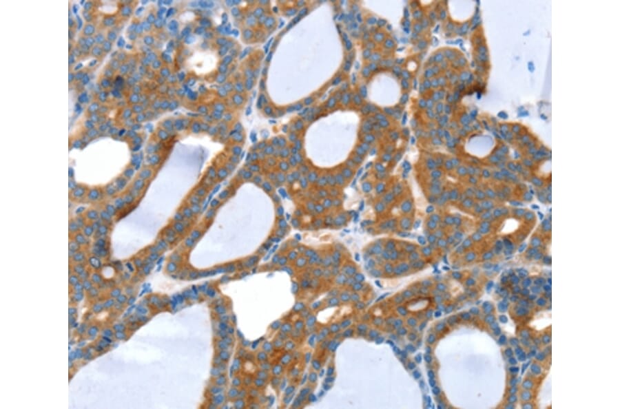 Immunohistochemistry - SNX5 Antibody from Signalway Antibody (37964) - Antibodies.com