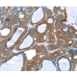 Immunohistochemistry - SNX5 Antibody from Signalway Antibody (37964) - Antibodies.com