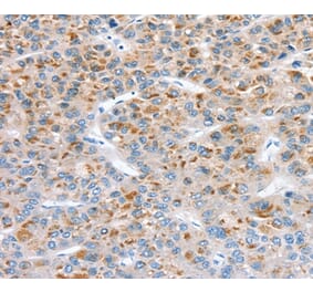Immunohistochemistry - SOD4 Antibody from Signalway Antibody (37969) - Antibodies.com
