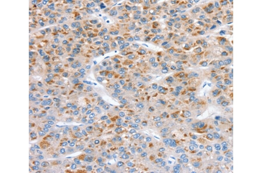 Immunohistochemistry - SOD4 Antibody from Signalway Antibody (37969) - Antibodies.com