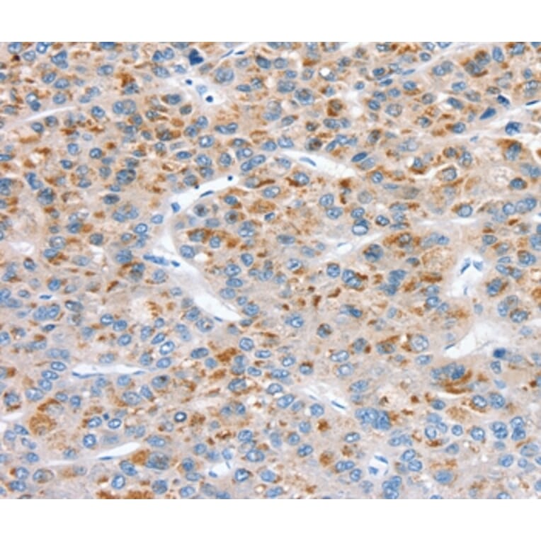 Immunohistochemistry - SOD4 Antibody from Signalway Antibody (37969) - Antibodies.com