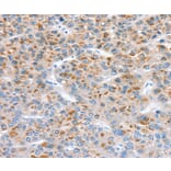 Immunohistochemistry - SOD4 Antibody from Signalway Antibody (37969) - Antibodies.com