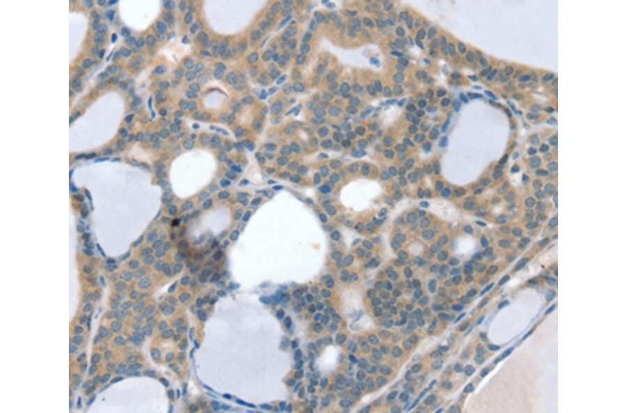 Immunohistochemistry - SOD4 Antibody from Signalway Antibody (37969) - Antibodies.com