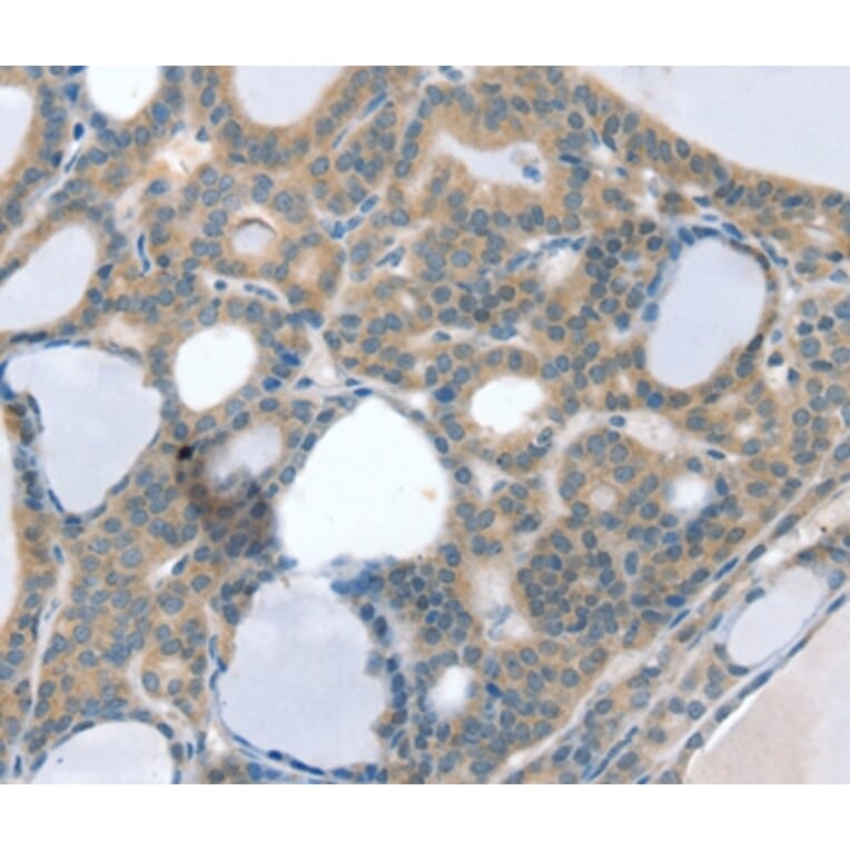Immunohistochemistry - SOD4 Antibody from Signalway Antibody (37969) - Antibodies.com