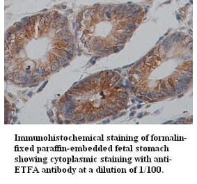 ETFA Antibody from Signalway Antibody (39354) - Antibodies.com