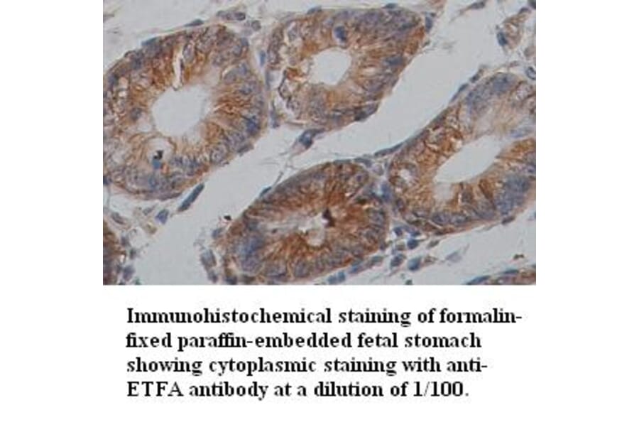 ETFA Antibody from Signalway Antibody (39354) - Antibodies.com