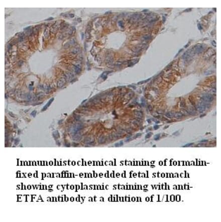 ETFA Antibody from Signalway Antibody (39354) - Antibodies.com
