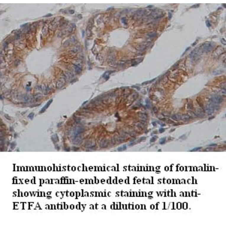 ETFA Antibody from Signalway Antibody (39354) - Antibodies.com