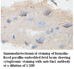 Sin1 Antibody from Signalway Antibody (39431) - Antibodies.com