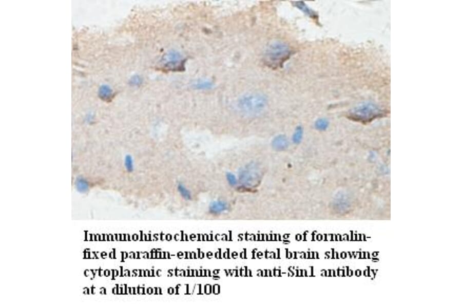 Sin1 Antibody from Signalway Antibody (39431) - Antibodies.com