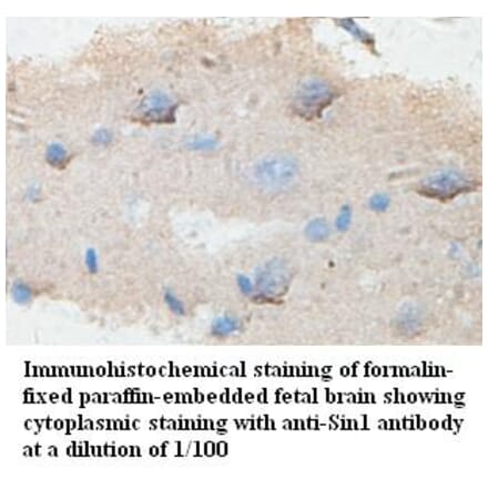 Sin1 Antibody from Signalway Antibody (39431) - Antibodies.com