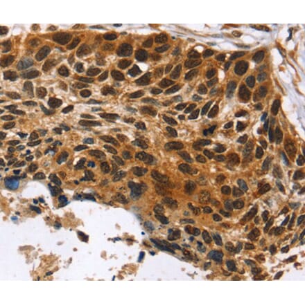 Immunohistochemistry - CDX1 Antibody from Signalway Antibody (40057) - Antibodies.com