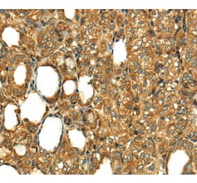 Immunohistochemistry - RLN1 Antibody from Signalway Antibody (40073) - Antibodies.com