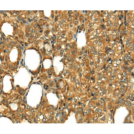 Immunohistochemistry - RLN1 Antibody from Signalway Antibody (40073) - Antibodies.com