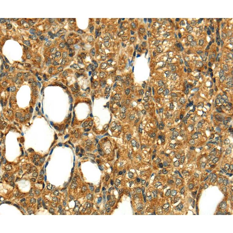 Immunohistochemistry - RLN1 Antibody from Signalway Antibody (40073) - Antibodies.com