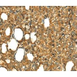 Immunohistochemistry - RLN1 Antibody from Signalway Antibody (40073) - Antibodies.com