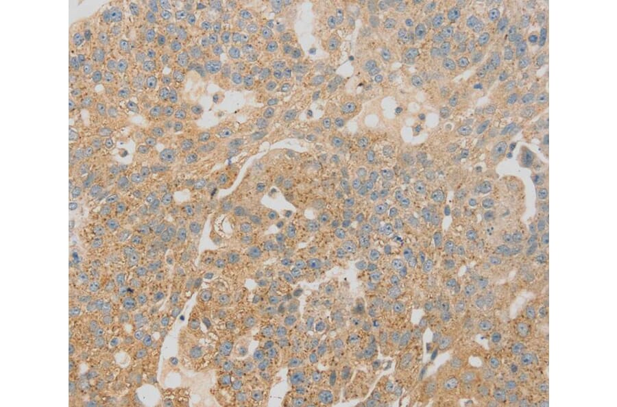 Immunohistochemistry - SCAP Antibody from Signalway Antibody (40093) - Antibodies.com