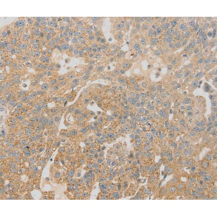 Immunohistochemistry - SCAP Antibody from Signalway Antibody (40093) - Antibodies.com