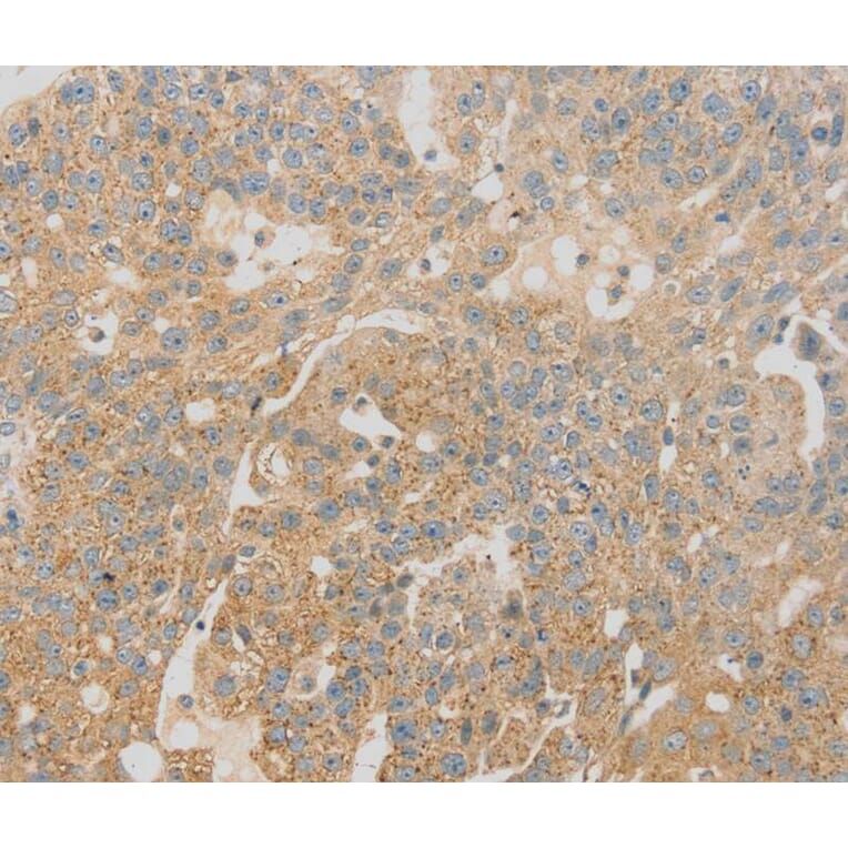 Immunohistochemistry - SCAP Antibody from Signalway Antibody (40093) - Antibodies.com