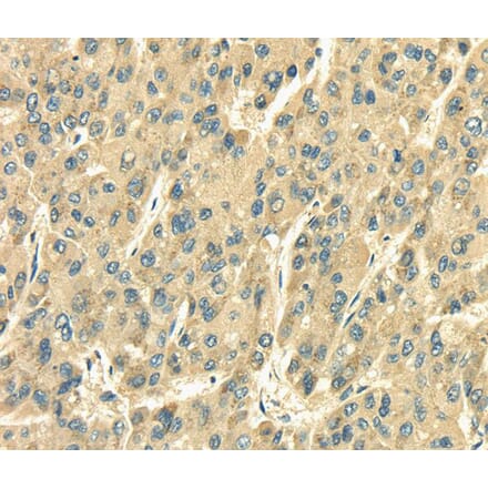 Immunohistochemistry - SDF4 Antibody from Signalway Antibody (40095) - Antibodies.com