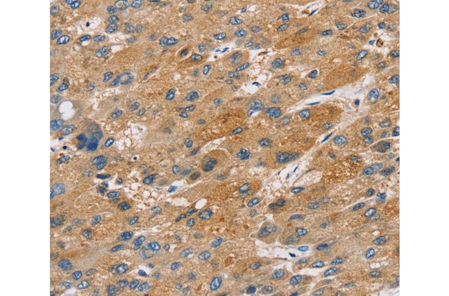 Immunohistochemistry - ST18 Antibody from Signalway Antibody (40120) - Antibodies.com