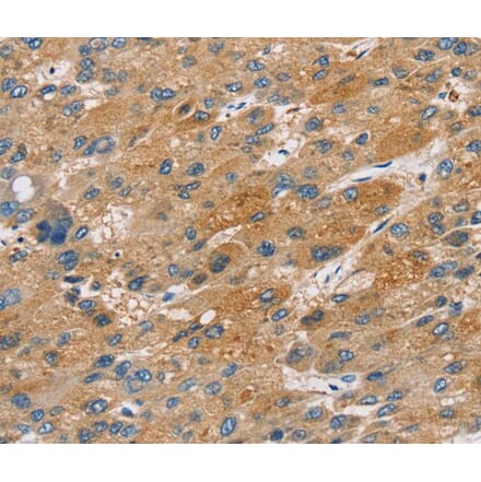 Immunohistochemistry - ST18 Antibody from Signalway Antibody (40120) - Antibodies.com