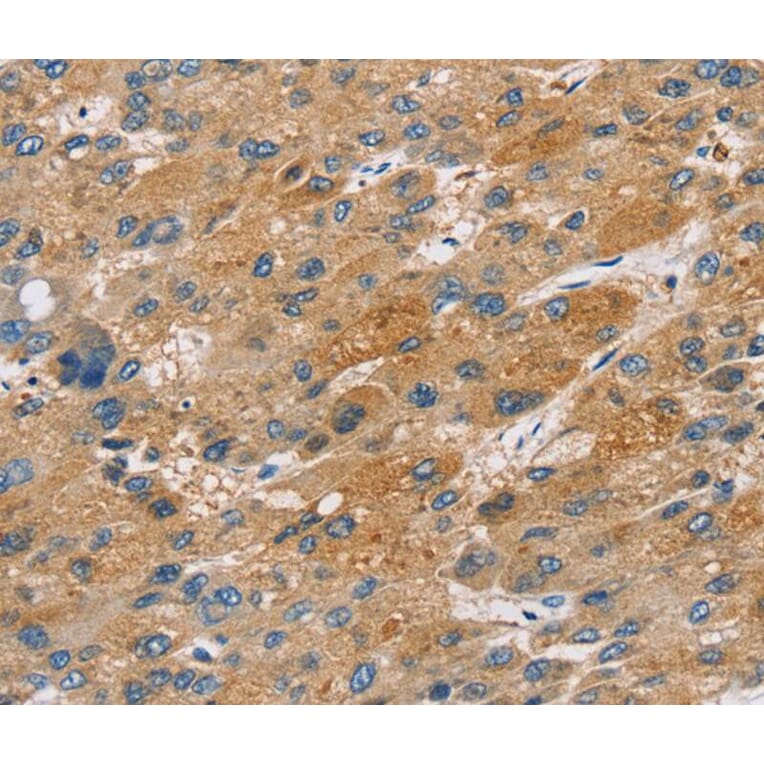 Immunohistochemistry - ST18 Antibody from Signalway Antibody (40120) - Antibodies.com