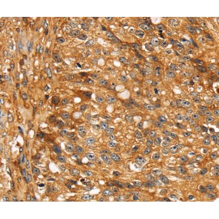 Immunohistochemistry - STC1 Antibody from Signalway Antibody (40121) - Antibodies.com