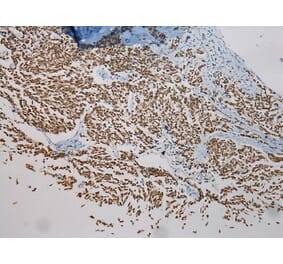 Immunohistochemistry - NME8 Antibody from Signalway Antibody (40171) - Antibodies.com