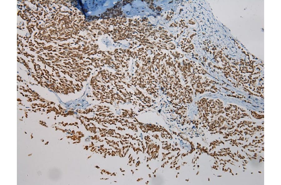 Immunohistochemistry - NME8 Antibody from Signalway Antibody (40171) - Antibodies.com