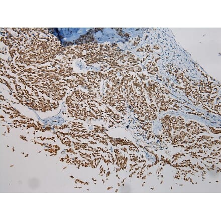 Immunohistochemistry - NME8 Antibody from Signalway Antibody (40171) - Antibodies.com