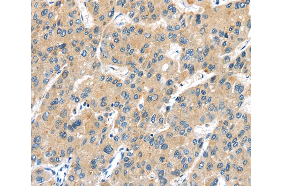 Immunohistochemistry - UBL3 Antibody from Signalway Antibody (40175) - Antibodies.com