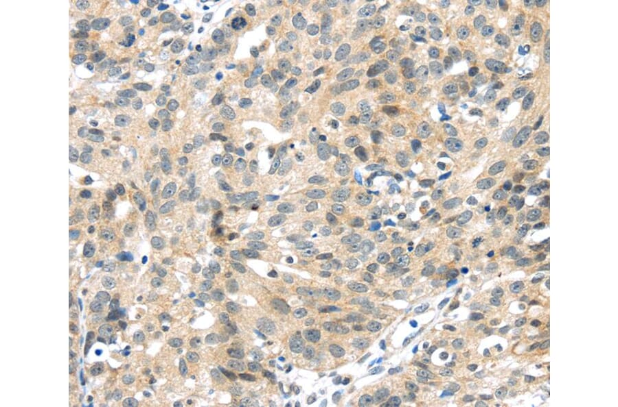 Immunohistochemistry - UBL3 Antibody from Signalway Antibody (40175) - Antibodies.com