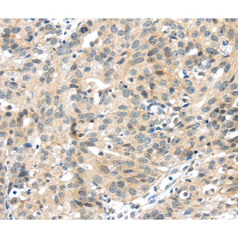 Immunohistochemistry - UBL3 Antibody from Signalway Antibody (40175) - Antibodies.com