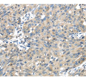 Immunohistochemistry - UGP2 Antibody from Signalway Antibody (40177) - Antibodies.com