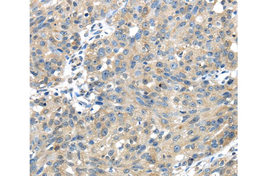 Immunohistochemistry - UGP2 Antibody from Signalway Antibody (40177) - Antibodies.com
